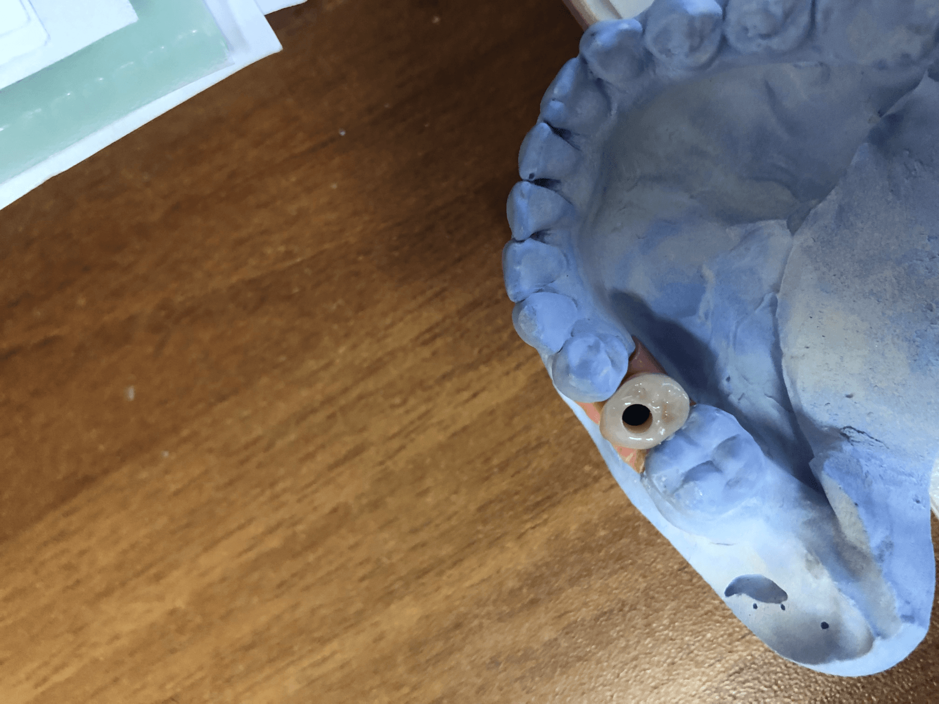 Produttore Di Apparecchiature Per Laboratori Odontoiatrici Fornitore