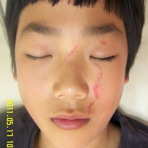 Skin Light Therapy in Cairns | Skin and Light Medi-Clinic