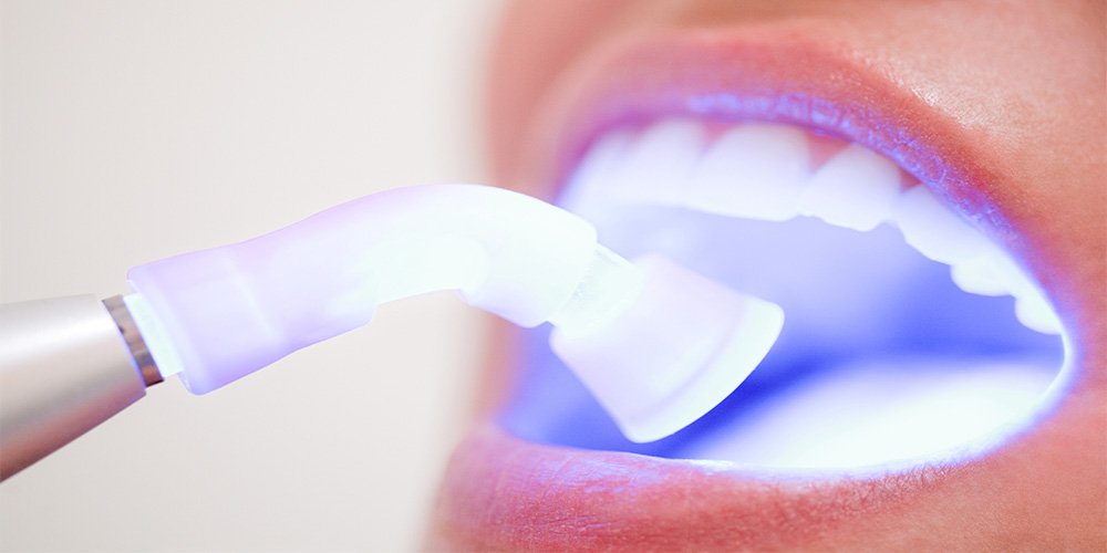 Oral Cancer Screening In Middletown NY Waldron Smile Center