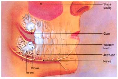 Wisdom Teeth Removal Middletown NY | Waldron Smile Center