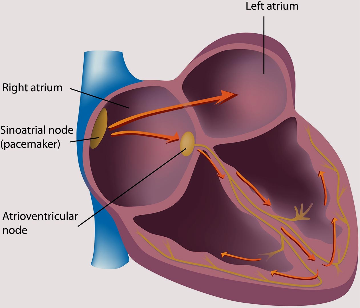 Symptoms Cardiologist Electrophysiologist Dr Kaveshree Govender