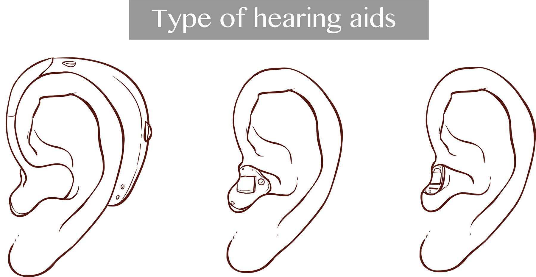 Types of Hearing Aids Northwest Arkansas Hearing Aids