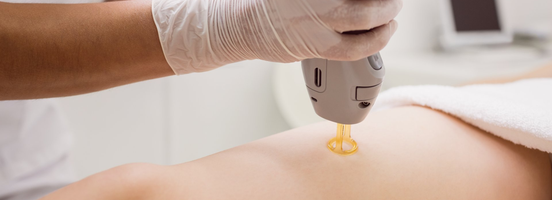 Cuanto Cuesta La Depilacion Laser En Colombia