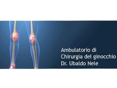 Quello che è varicosity endovenoso