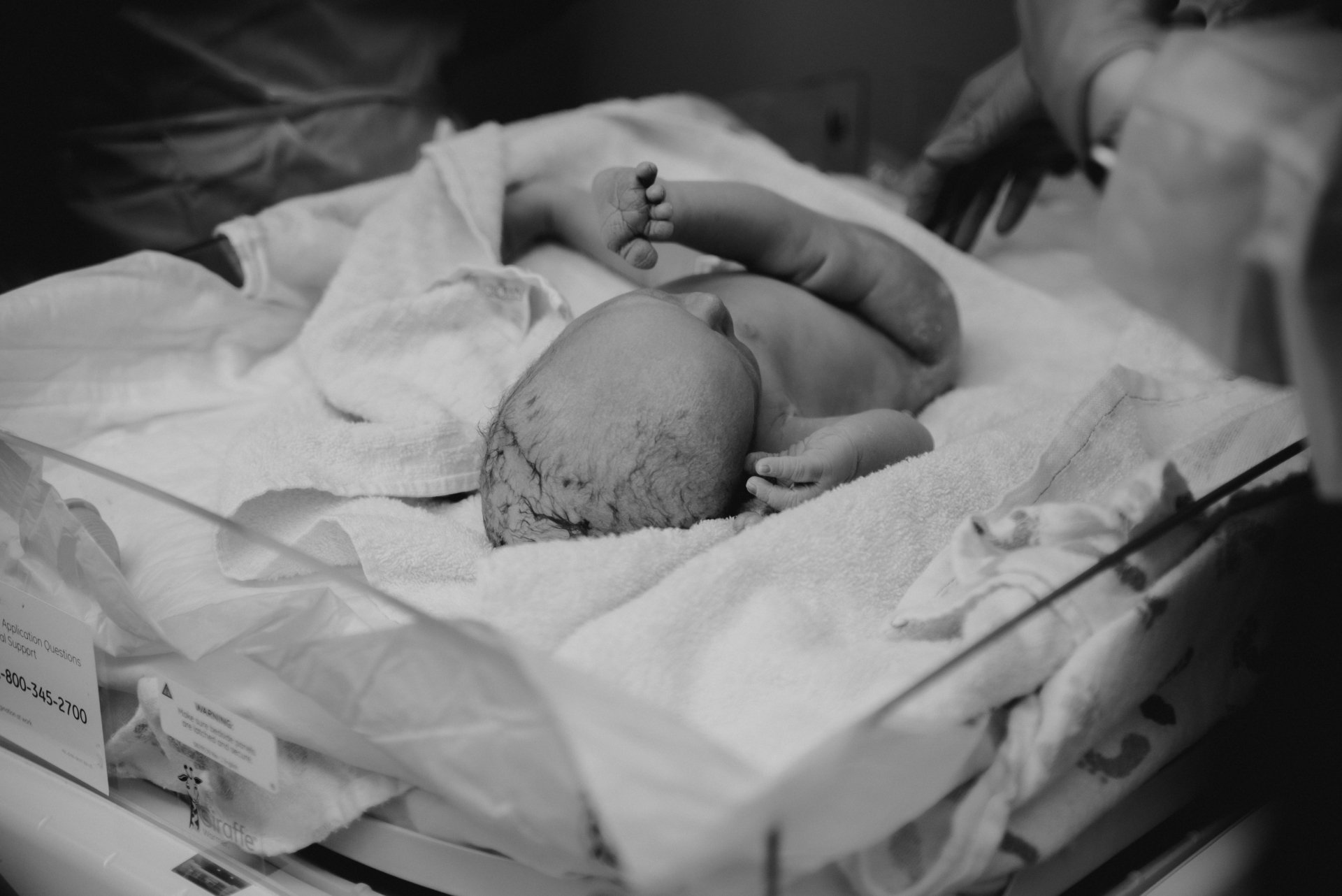 Piedmont Newnan Birth Breech CSection