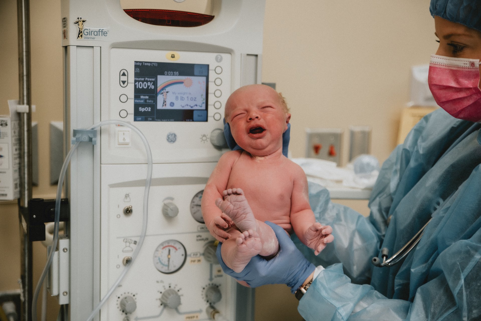 Piedmont Newnan Birth Breech CSection