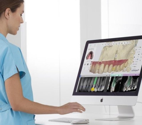 implantologia computer guidata