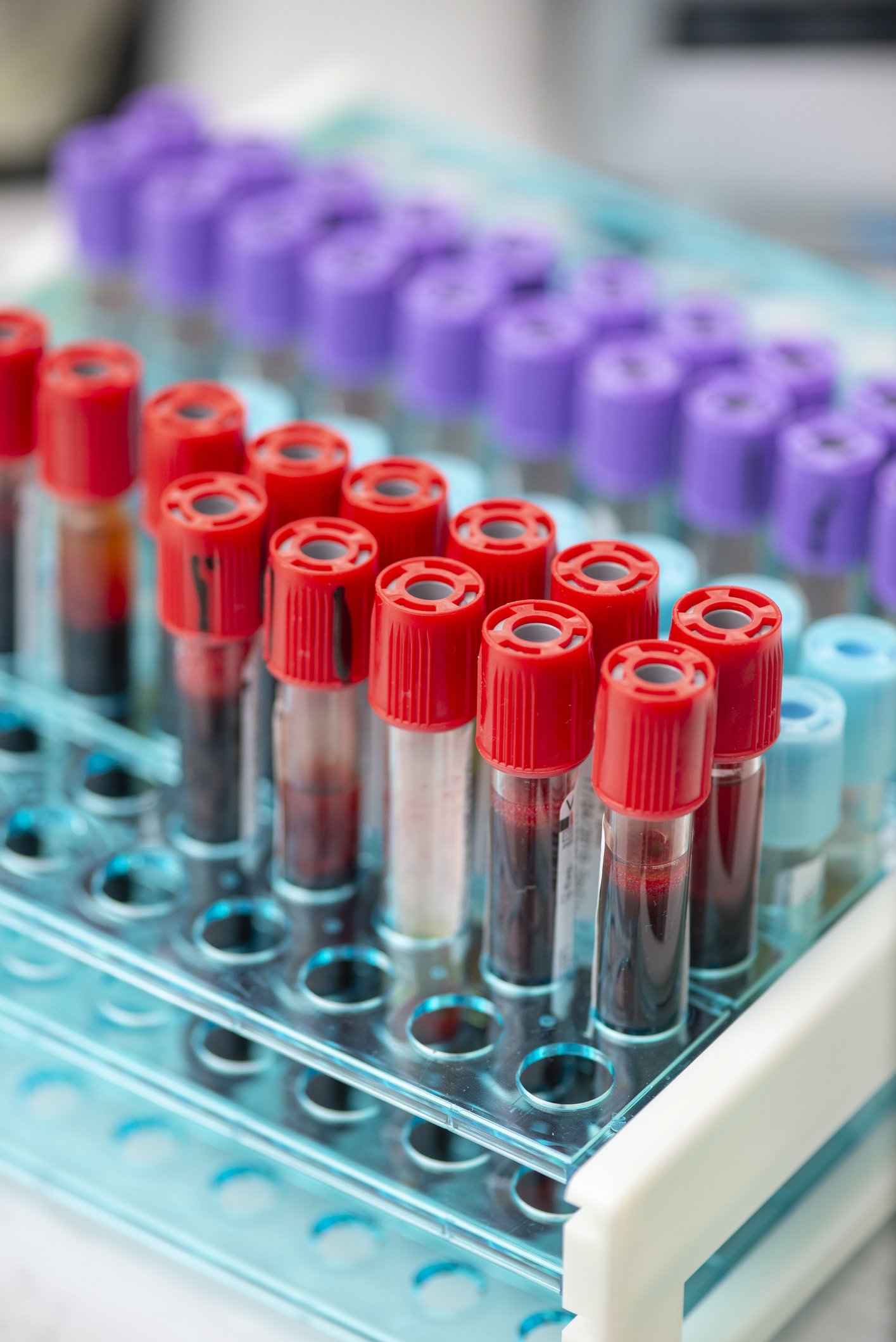 Anticoagulation Clinic St. Clair Shores, MI Eastlake Cardiovascular