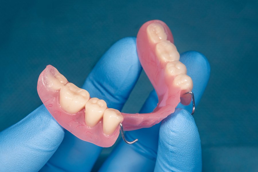 Dentures — Louisville, Ohio — Louisville Dental Clinic