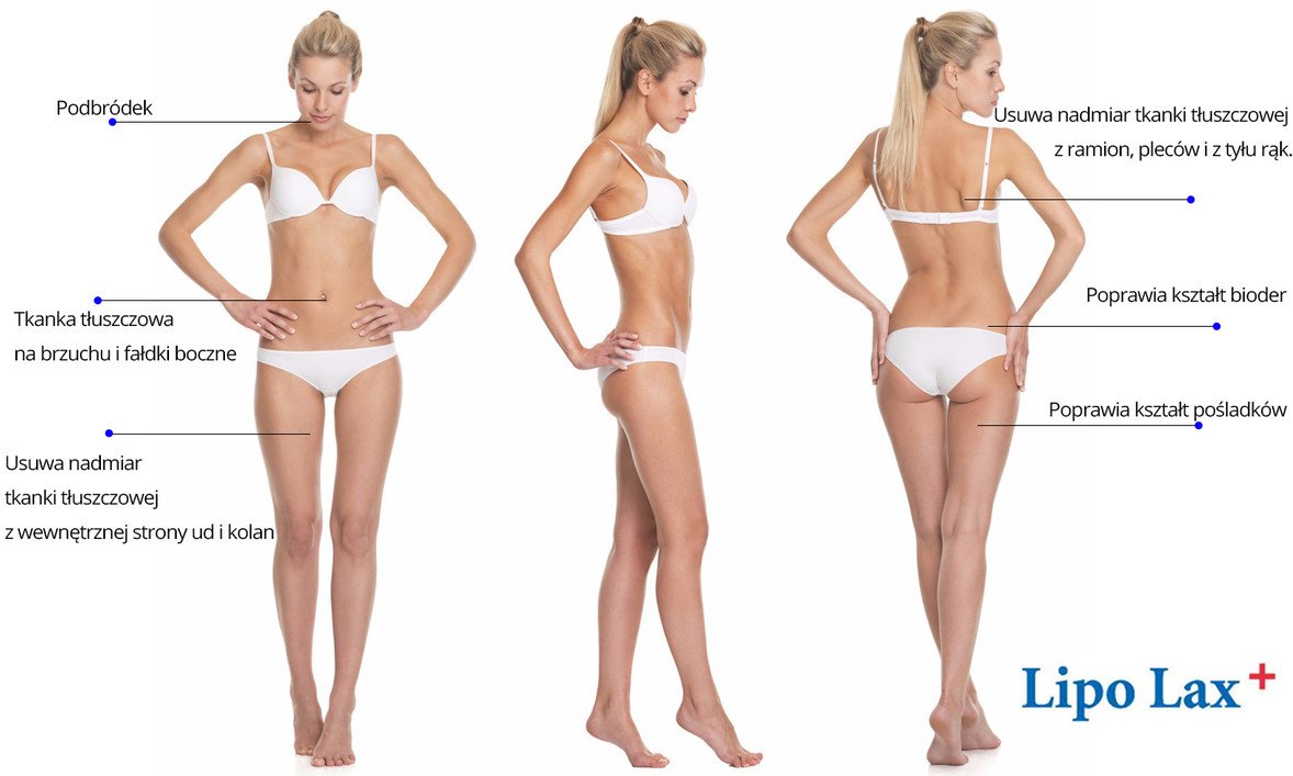 Lipoliza Iniekcyjna Lipoliza Iniekcyjna