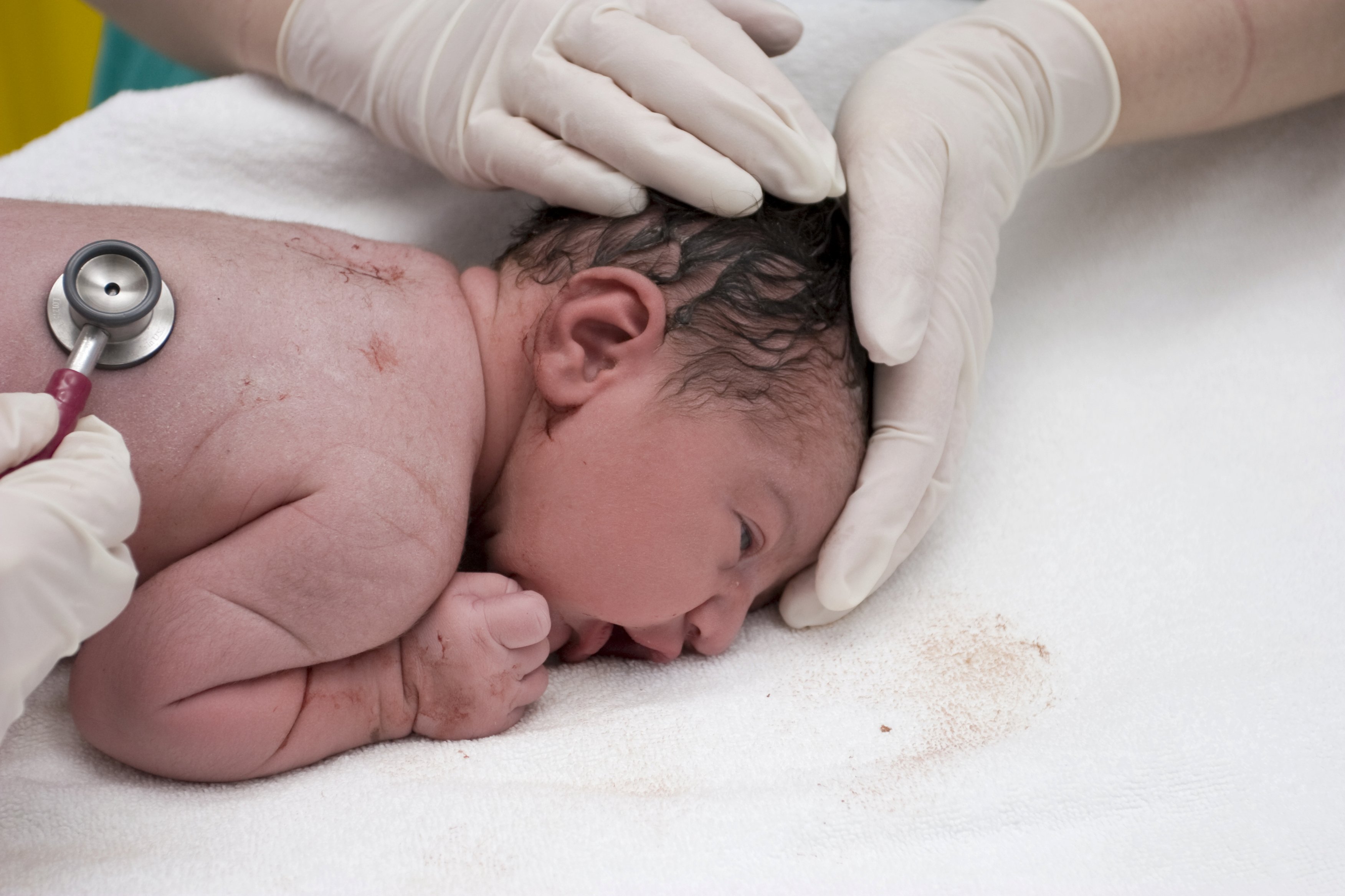 Home birth model of care Home birth model of care
