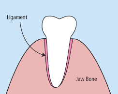 dental extractions animation
