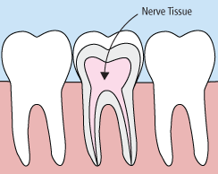 root canals in Alexandria, VA 22314