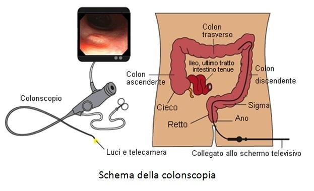 dieta preparazione colonscopia virtuale dieta preparazione colonscopia virtuale