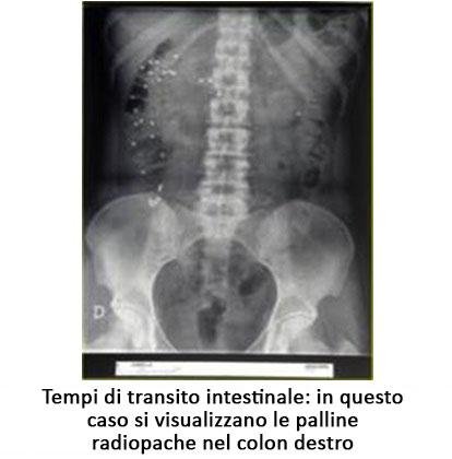 dolore pelvico stipsi