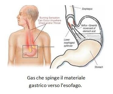 dieta morbida per una colonscopia