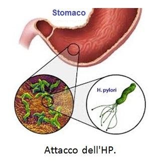 dieta per batteri helicobacter pylori dieta per batteri helicobacter pylori
