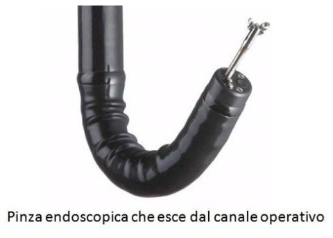 preparazione colonscopia con citrafleet