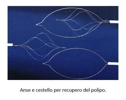 dieta dopo polipectomia colon