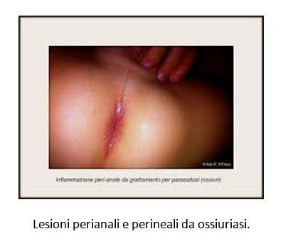 trattamento delle infezioni cutanee parassitarie trattamento delle infezioni cutanee parassitarie