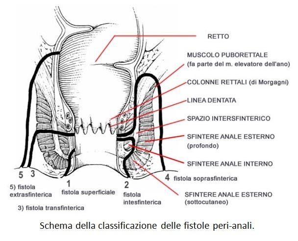 cosa significa fluido pelvico libero