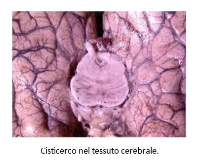 parassita cerebrale bianco parassita cerebrale bianco
