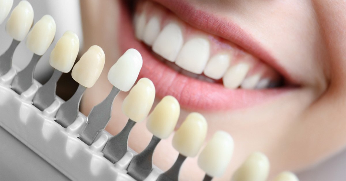 teeth shades shade whitening