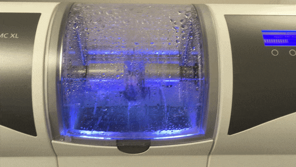 Same-Day CEREC Crowns