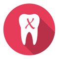 Tooth Extraction