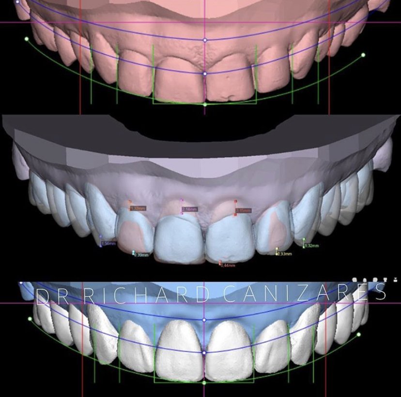La mejor TECNOLOGÍA para el cuidado dental Dental Esthetic Solutions