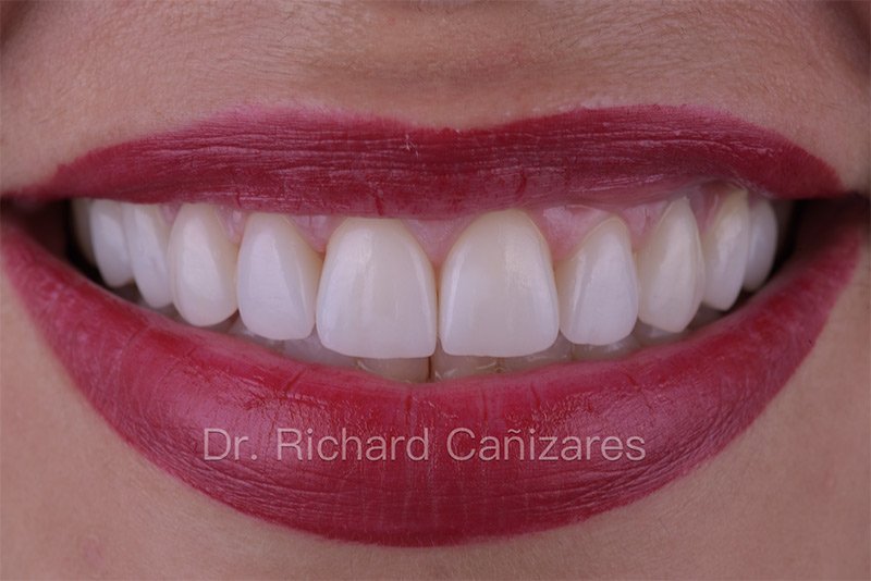 DENTAL ESTHETIC SOLUTIONS Dentistas y Prostodoncistas San Juan PR