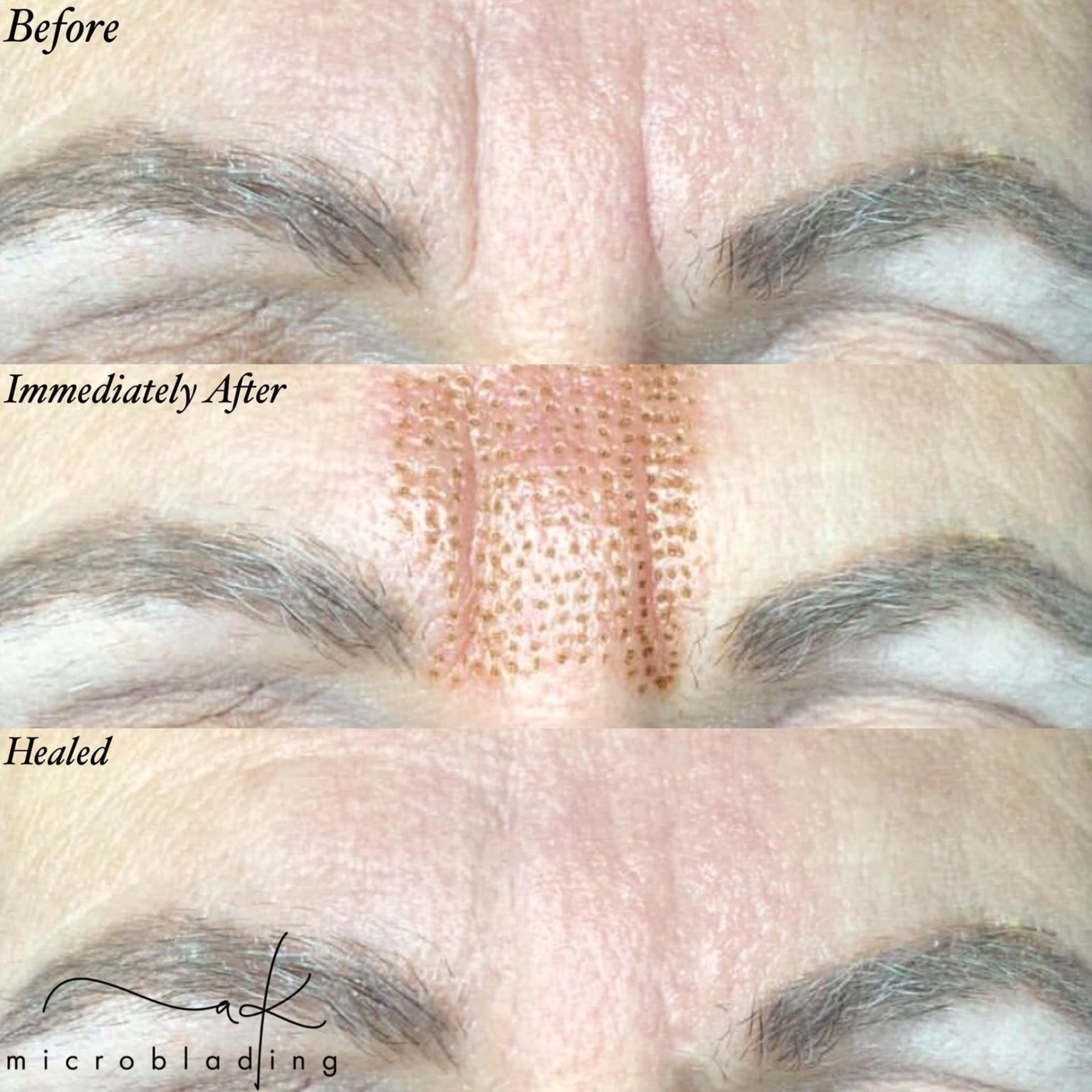 Microblading Before & Afters AK Microblading in Odessa, FL