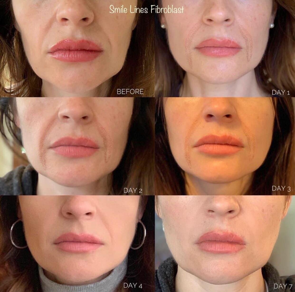 Microblading Before & Afters AK Microblading in Odessa, FL