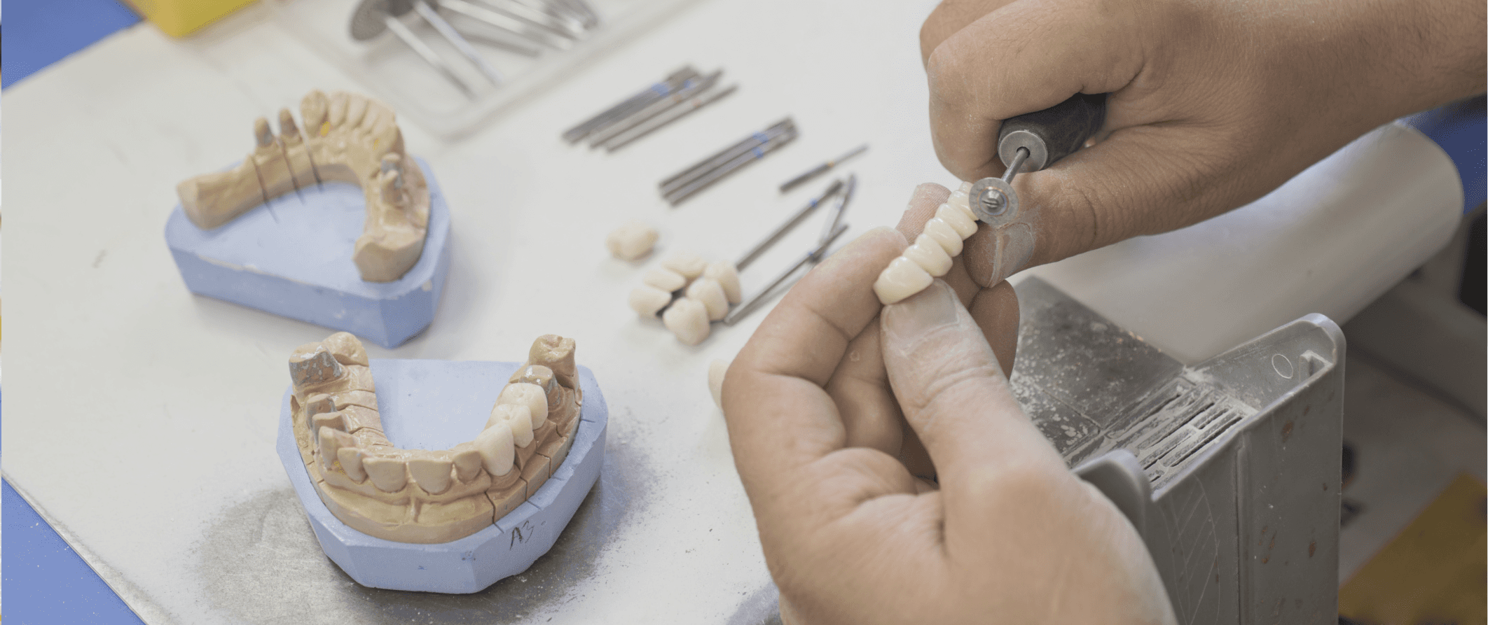 Dental Prosthesis Hobart Total Denture Care Clinics Total Denture