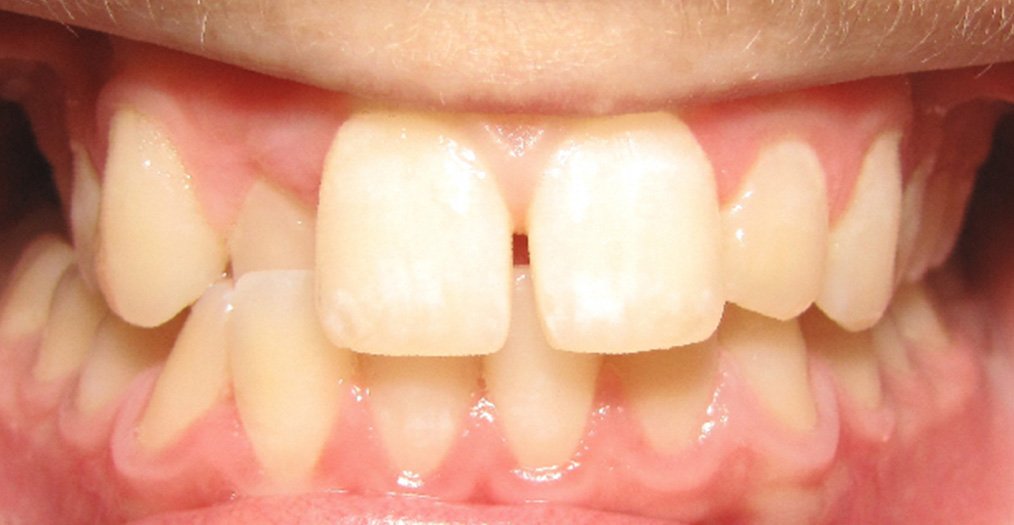 Your Trusted Dental Office in Cincinnati Blue Ash Dental Group