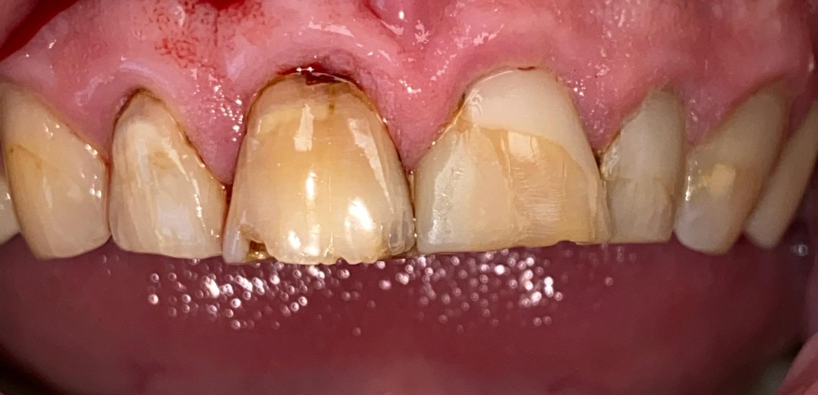 Your Trusted Dental Office in Cincinnati Blue Ash Dental Group