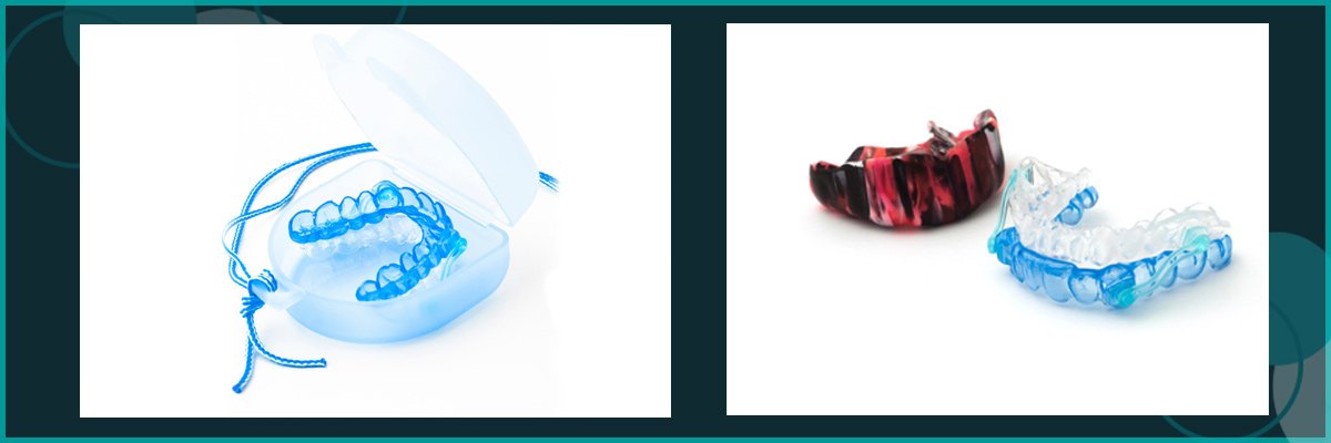 belmont denture clinic mouth guards