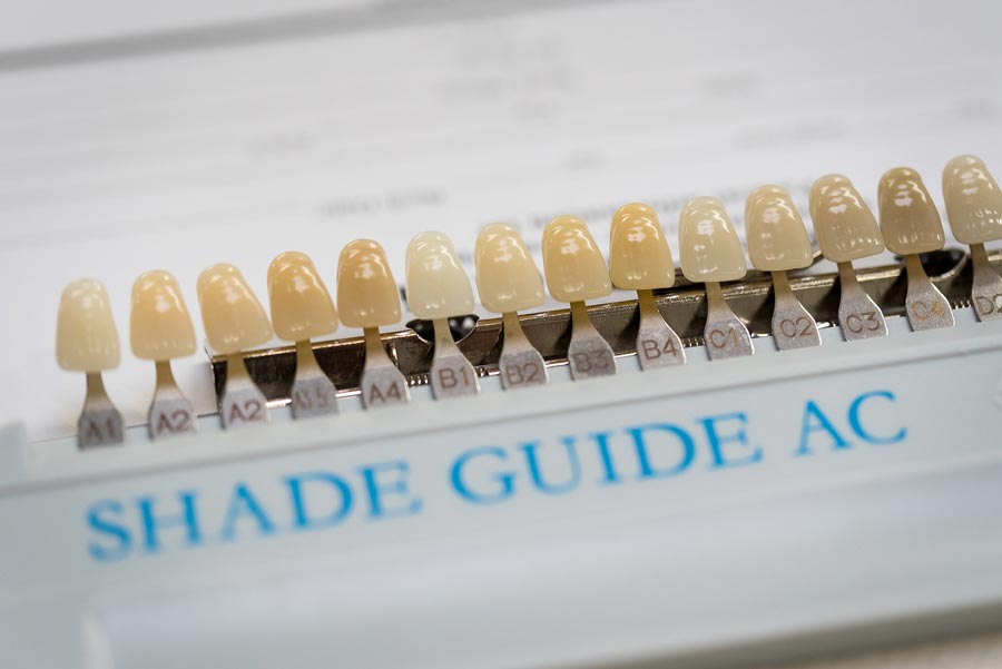 Complete Dentures & Teeth Extractions Denturist Great Falls, MT