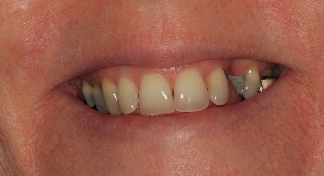 Dental treatments Crawley Dental Clinic