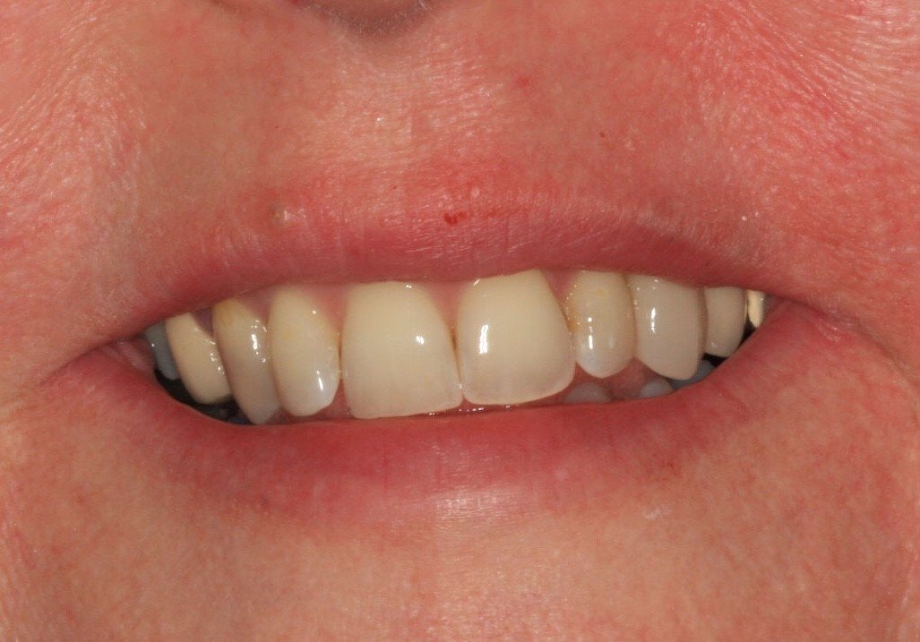 Dental treatments Crawley Dental Clinic