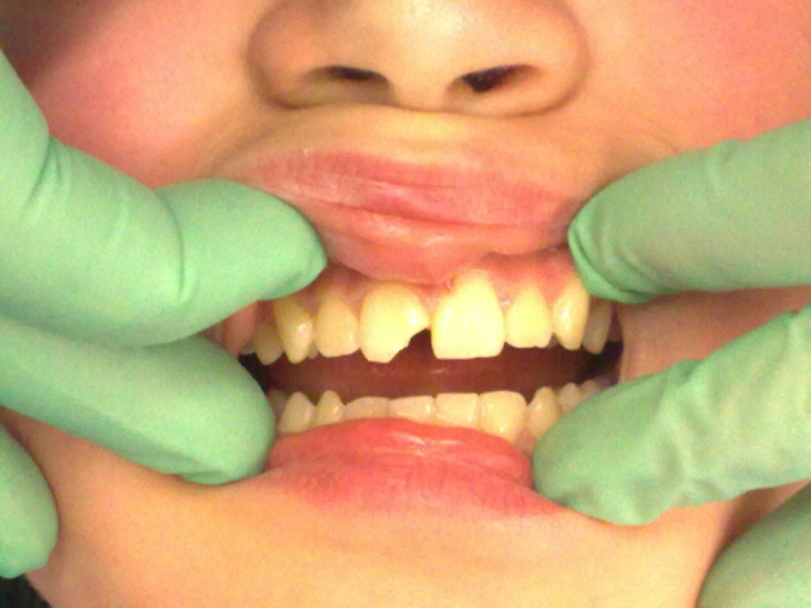 Dental treatments Crawley Dental Clinic