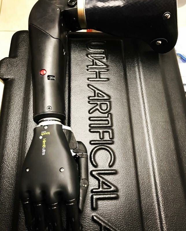 Gallery AOD Prosthetics & Orthotics San Antonio