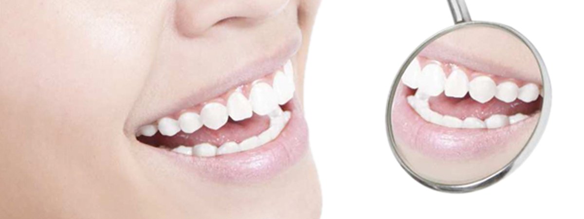 Family Dental care clear smile Someone utilizing our dental services in Penrith
