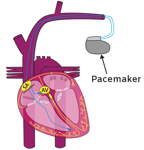 Heart Electrical System ECG and Sequence of Electrical Conduction