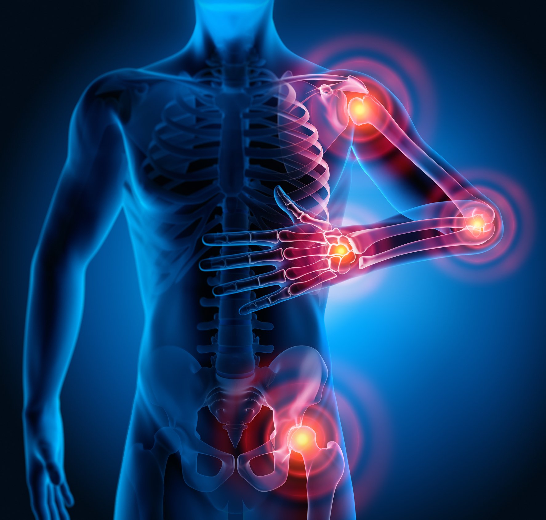 Immediate Relief: Joint Pain And $441 A Month Awaits You! - yinjapy