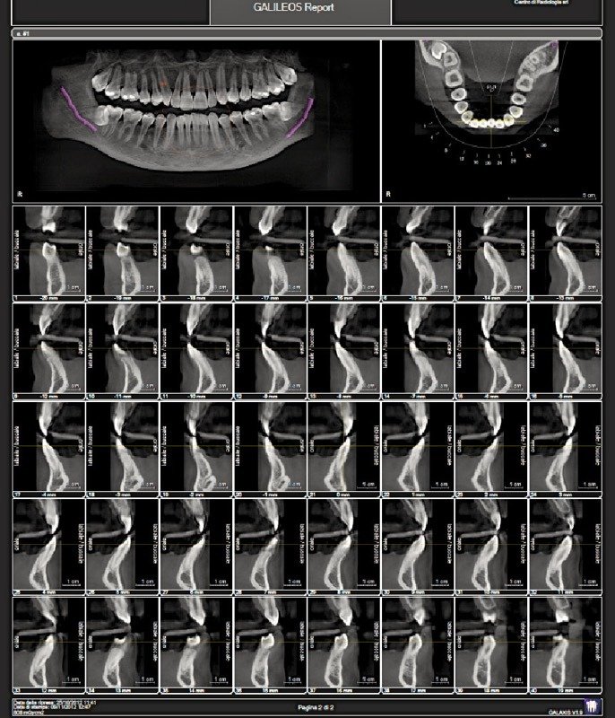 Ortopantomografie e Dentalscan Cone Beam in 3D CBCT Bagheria, Palermo