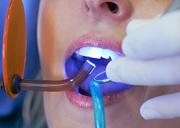 woman-dental-care woman-dental-care