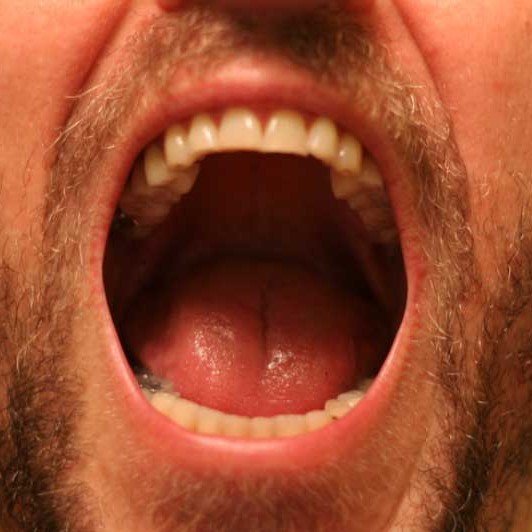 I Thought My Tooth Wasn t Supposed To Hurt After A Root Canal 