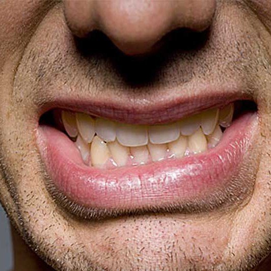 Grinding And The Damage It Can Do.