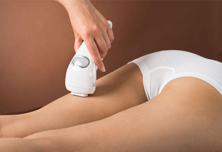 Epilazione e sole Epilazione Laser
